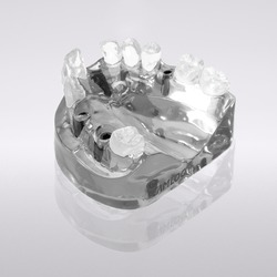 Picture of CONELOG® Demo model, upper jaw, 4 implants Ø 4.3 mm