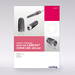 Picture of Surgical procedure with the CAMLOG® SCREW-LINE Implant