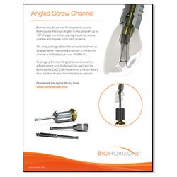 Picture of Angled Screw Channel Detail Sheet