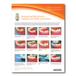 Picture of Restoring BioHorizons Implants using Locator Abutments