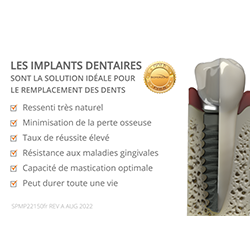 Picture of Dental Implant Tooth vs. Natural Tooth Patient Animation - French