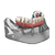 Picture of TeethXpress Patient Education Model